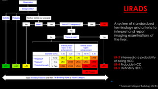 * American College of Radiology (ACR).
LIRADS
A system of standardized
terminology and criteria to
interpret and report
imaging examinations of
the liver.
LR-3 Intermediate probability
of being HCC
LR-4 Probably HCC
LR-5 Definitely HCC.
 