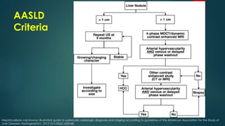 AASLD
Criteria
Hepatocellular carcinoma: illustrated guide to systematic radiologic diagnosis and staging according to guidelines of the American Association for the Study of
Liver Diseases. Radiographics. 2013 Oct;33(6):1653-68.
 