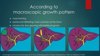 According to
macroscopic growth pattern
 mass-forming
 periductal infiltrating: most common at the hilum
 intraductal: slow growing with better prognosis
Cholangiocarcinoma: pictorial essay of CT and cholangiographic findings. Radiographics. 2002 Jan-Feb;22(1):173-87.
 