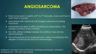 ANGIOSARCOMA
 Rare tumor seen in adults of 5th to 7th decade, more common in
men than in women.
 associated with chemical carcinogens exposure including
Thorotrast.
 Metastases are seen in 60% of patients at presentation, the
median survival is only 6 months.
 On USG, either multiple nodules or a solitary mass can be
demonstrated.
 The echotexture of an angiosarcoma varies according to the
degree of internal necrosis and hemorrhage.
Malignant vascular tumors of the liver: radiologic-pathologic correlation.
Radiographics. 1994 Jan;14(1):153-66.
 