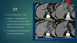 CT
 Focal calcification -7.5%
 Majority – hyperdense on
arterial phase, as HCCs take
supply from the hepatic artery
rather than portal vein
 Heterogenous enhancement
due to central necrosis
 