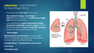 Malignant lung tumor.pptx presentationss | PPTX