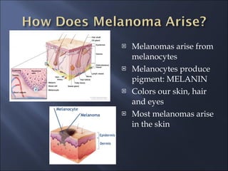 Melanomas arise from melanocytes Melanocytes produce pigment: MELANIN Colors our skin, hair and eyes Most melanomas arise in the skin 