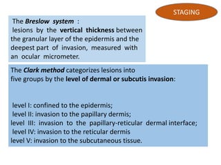 Malignant melanoma | PPTX