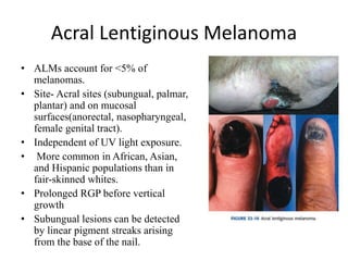 Acral Lentiginous Melanoma
• ALMs account for <5% of
melanomas.
• Site- Acral sites (subungual, palmar,
plantar) and on mucosal
surfaces(anorectal, nasopharyngeal,
female genital tract).
• Independent of UV light exposure.
• More common in African, Asian,
and Hispanic populations than in
fair-skinned whites.
• Prolonged RGP before vertical
growth
• Subungual lesions can be detected
by linear pigment streaks arising
from the base of the nail.
 
