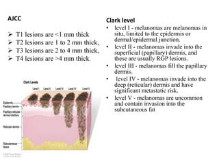 AJCC
 T1 lesions are <1 mm thick
 T2 lesions are 1 to 2 mm thick,
 T3 lesions are 2 to 4 mm thick,
 T4 lesions are >4 mm thick.
Clark level
• level I - melanomas are melanomas in
situ, limited to the epidermis or
dermal/epidermal junction.
• level II - melanomas invade into the
superficial (papillary) dermis, and
these are usually RGP lesions.
• level III - melanomas fill the papillary
dermis.
• level IV - melanomas invade into the
deep (reticular) dermis and have
significant metastatic risk.
• level V - melanomas are uncommon
and contain invasion into the
subcutaneous fat
 
