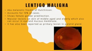 lipo c with b12 with tirzepatide Melanoma: current perspectives on diagnosis and management