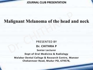 Malignant Melanoma of the head and neck
JOURNAL CLUB PRESENTATION
PRESENTED BY
Dr. CHITHRA P
Senior Lecturer
Dept of Oral Medicine & Radiology
Malabar Dental College & Research Centre, Manoor
Chekannoor Road, Mudur PO, 679578,
 
