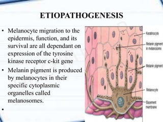 • Melanocyte migration to the
epidermis, function, and its
survival are all dependant on
expression of the tyrosine
kinase receptor c-kit gene
• Melanin pigment is produced
by melanocytes in their
specific cytoplasmic
organelles called
melanosomes.
•
ETIOPATHOGENESIS
 