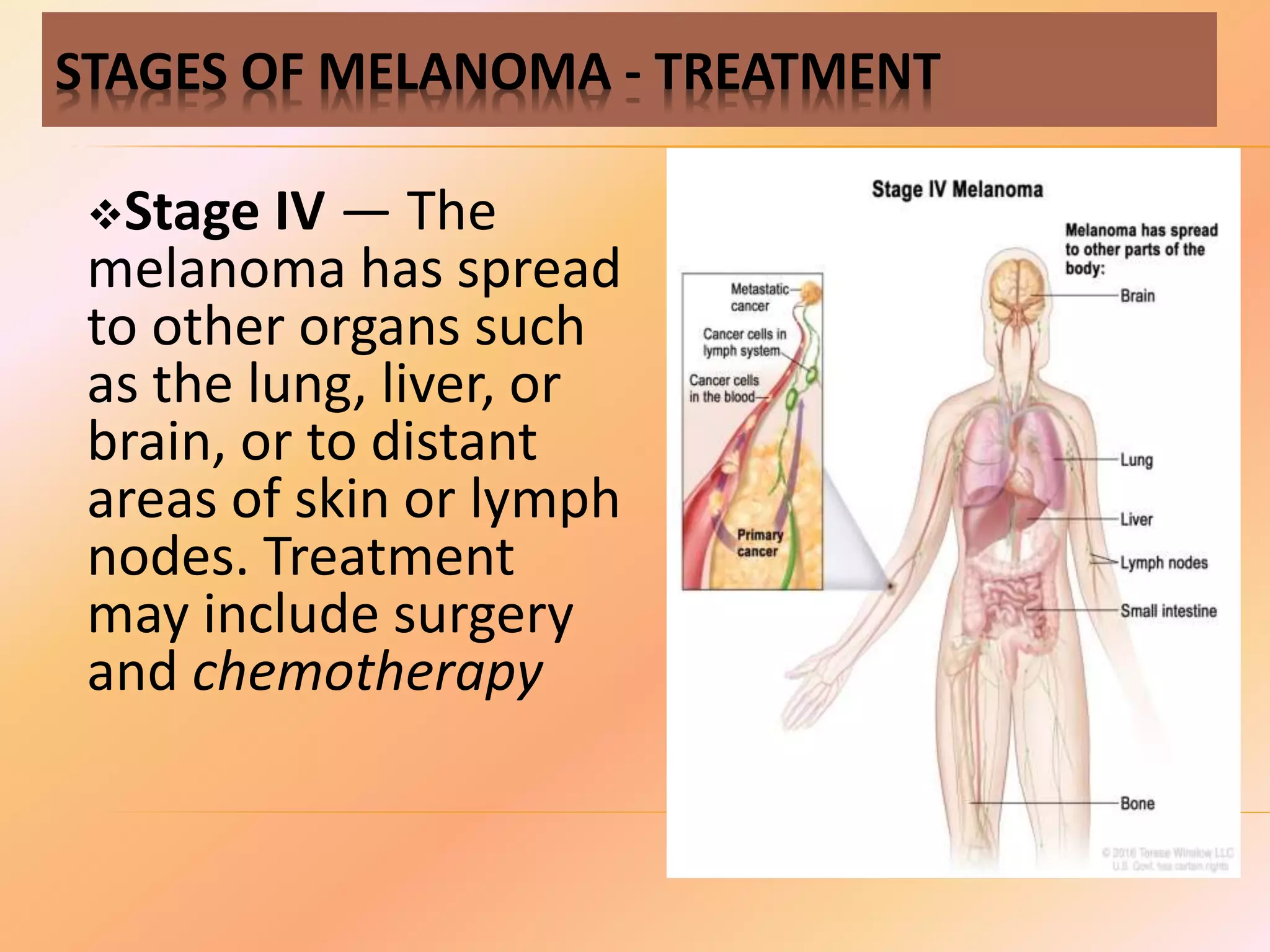 Malignant melanoma | PPTX