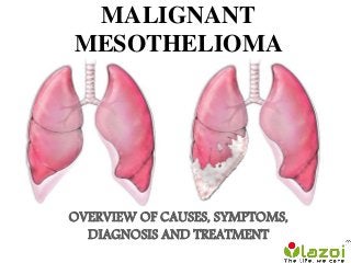 MALIGNANT
MESOTHELIOMA
OVERVIEW OF CAUSES, SYMPTOMS,
DIAGNOSIS AND TREATMENT
 