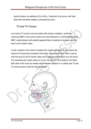 Malignant neoplasms of the oral cavity | PDF