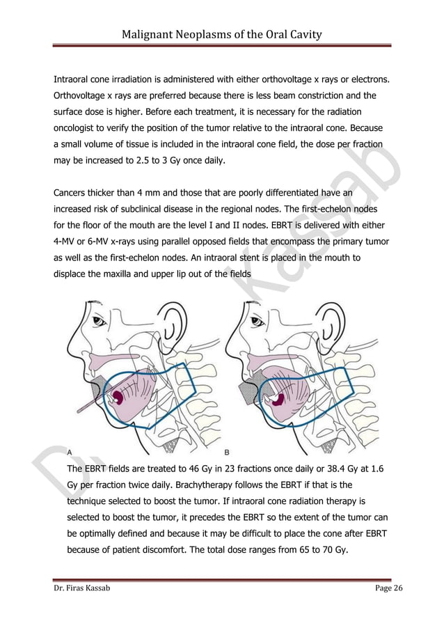 Malignant neoplasms of the oral cavity | PDF