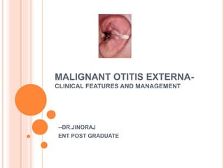MALIGNANT OTITIS EXTERNA-
CLINICAL FEATURES AND MANAGEMENT
--DR.JINORAJ
ENT POST GRADUATE
 