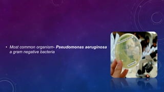 • Most common organism- Pseudomonas aeruginosa
a gram negative bacteria
 