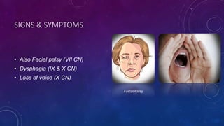 SIGNS & SYMPTOMS
• Also Facial palsy (VII CN)
• Dysphagia (IX & X CN)
• Loss of voice (X CN)
Facial Palsy
 