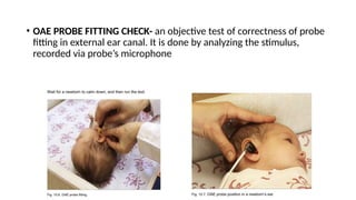 • OAE PROBE FITTING CHECK- an objective test of correctness of probe
fitting in external ear canal. It is done by analyzing the stimulus,
recorded via probe’s microphone
 
