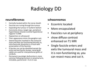Radiology DD
neurofibromas
• Centrally located within the nerve sheath
• Fascicles are runnig through the tumour
• Expanding the tumour in fusiform fashion
• Commonly show a target sign, peripheral
hyperintense rimand a central hypointense
regionin T2 MRI
• Hypoechoic on ultrasound
• Their appearance mimic the ganglion cyst.
• Several fascicles involved in the tumoural
mass and they are functioning fascicles so,
intra-fascicular dissection is a must with
preservation of the fascicles.
• If fasciles can not be idnetified except the
entry and exit fascile stumps, nerve graft
cables are used for interpositional grafts or
conduits.
• Permanent neurologic dysfunction is more
common following tumours in proximal arm,
immobile, painful and > 4 cm in size
schwannomas
• Eccentric located
• More encapsulated
• Fascicles run at periphery
• show diffuse contrast
enhansed on T1 MRI
• Single fascicle enters and
exits the tumoural mass and
it is non-functioning so, you
can resect mass and cut it.
11
 