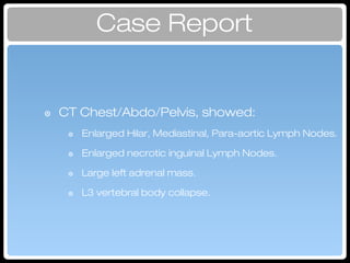 Case Report
๏ CT Chest/Abdo/Pelvis, showed:
๏ Enlarged Hilar, Mediastinal, Para-aortic Lymph Nodes.
๏ Enlarged necrotic inguinal Lymph Nodes.
๏ Large left adrenal mass.
๏ L3 vertebral body collapse.
Investigation
 