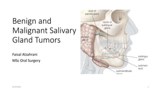 Benign and
Malignant Salivary
Gland Tumors
Faisal Alzahrani
MSc Oral Surgery
6/25/2022 1
 