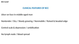 BCC Contd’
CLINICAL FEATURES OF BCC
Ulcer on face in middle-aged man
Nontender / Dry / Slowly growing / Nonmobile / Raised & beaded edge
Central scab & depression / umbilication
No lymph node / blood spread
 