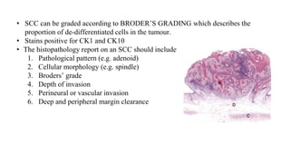 Malignant skin lesions | PPTX