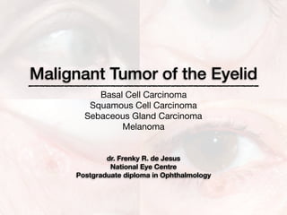 Malignant Tumor of the Eyelid
Basal Cell Carcinoma

Squamous Cell Carcinoma

Sebaceous Gland Carcinoma

Melanoma
dr. Frenky R. de Jesus
National Eye Centre
Postgraduate diploma in Ophthalmology
 
