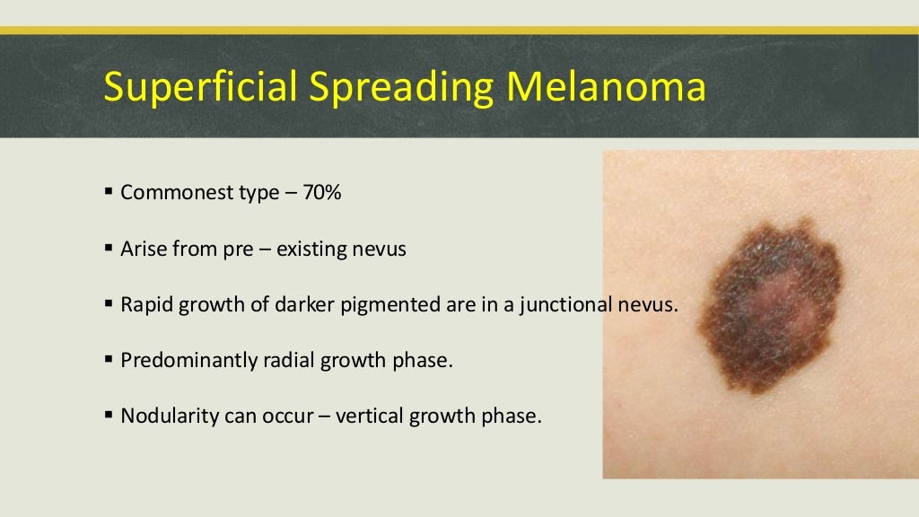 Malignant tumors of skin