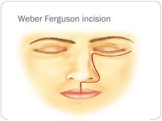 Malignant tumour of nose pns | PPT