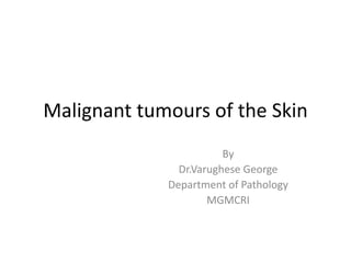 Malignant tumours of the Skin
By
Dr.Varughese George
Department of Pathology
MGMCRI
 