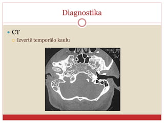 Diagnostika
 CT
 Izvertē temporālo kaulu
 