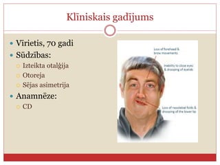 Klīniskais gadījums
 Vīrietis, 70 gadi
 Sūdzības:
 Izteikta otalģija
 Otoreja
 Sējas asimetrija
 Anamnēze:
 CD
 