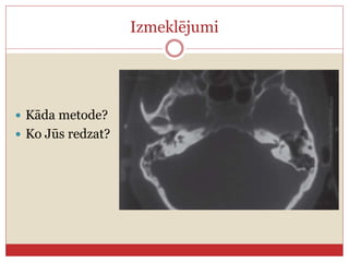Izmeklējumi
 Kāda metode?
 Ko Jūs redzat?
 