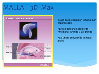 MALLA 3D- Max
Malla para reparación inguinal por
laparoscopia
•Existe derecha e izquierda
•Mediana, Grande y Ex-grande
•Se utiliza en lugar de la malla
plana

 