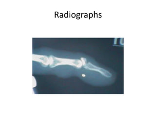 Radiographs
 
