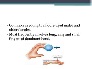 • Common in young to middle-aged males and
older females.
• Most frequently involves long, ring and small
fingers of dominant hand.
 