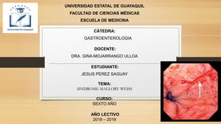 UNIVERSIDAD ESTATAL DE GUAYAQUIL
FACULTAD DE CIENCIAS MÉDICAS
ESCUELA DE MEDICINA
CÁTEDRA:
GASTROENTEROLOGIA
DOCENTE:
DRA. GINA MOJARRANGO ULLOA
ESTUDIANTE:
JESUS PEREZ SAGUAY
TEMA:
SINDROME MALLORY WEISS
CURSO:
SEXTO AÑO
AÑO LECTIVO
2018 – 2019
 