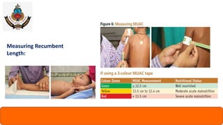 Recumbent Length Malnutrition In Indian context | PPTX