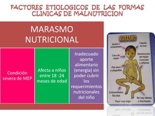 FACTORES  ETIOLOGICOS  DE  LAS  FORMAS CLINICAS DE MALNUTRICION
