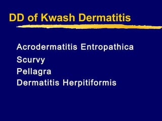 DD of Kwash Dermatitis
Acrodermatitis Entropathica
Scurvy
Pellagra
Dermatitis Herpitiformis

 