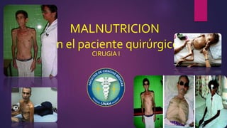 MALNUTRICION
en el paciente quirúrgico
CIRUGIA I
 
