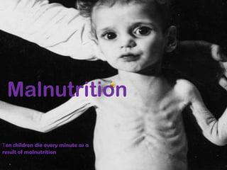 Malnutrition Ten children die every minute as a result of malnutrition 