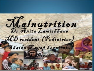 Malnutrition
Dr.Anita Lamichhane
MD resident (Pediatrics)
Shaikh Zayed hospital ,
       Lahore
 