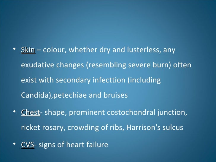 Harrison Sulcus Rickets & osteomalacia / Translation memories are
