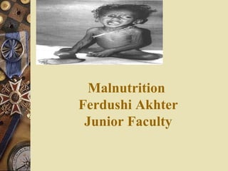 Malnutrition 
Ferdushi Akhter 
Junior Faculty 
 