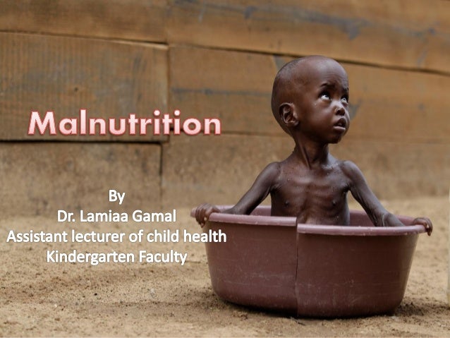 malnutrition