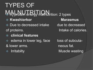 TYPES OF
MALNUTRITION A] protein energy malnutrition: 2 types
 Kwashiorkor Marasmus
 Due to decreased intake due to decreased
of proteins. Intake of calories.
 clinical features
 edema in lower leg, face loss of subcuta-
& lower arms. neous fat.
 Irritabilty Muscle wasting
 
