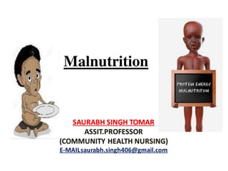 Malnutrition
SAURABH SINGH TOMAR
ASSIT.PROFESSOR
(COMMUNITY HEALTH NURSING)
E-MAIL-saurabh.singh406@gmail.com
 