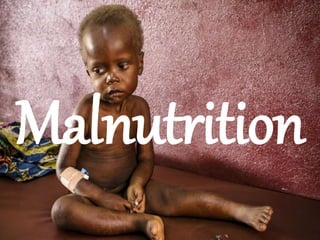 Malnutrition
 