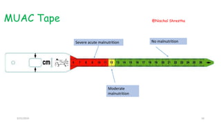MUAC Tape
No malnutrition
Moderate
malnutrition
Severe acute malnutrition
3/21/2019
@Nischal Shrestha
10
 